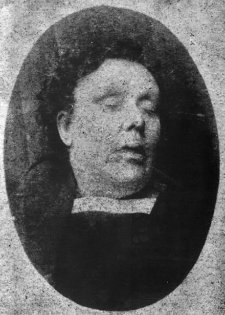 Mortuary photo of Annie Chapman